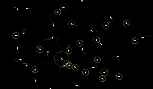 The image shows several animated sperm cells, some of which are surrounded by a small circle. A low number of sperm can indicate a low sperm count in men.
